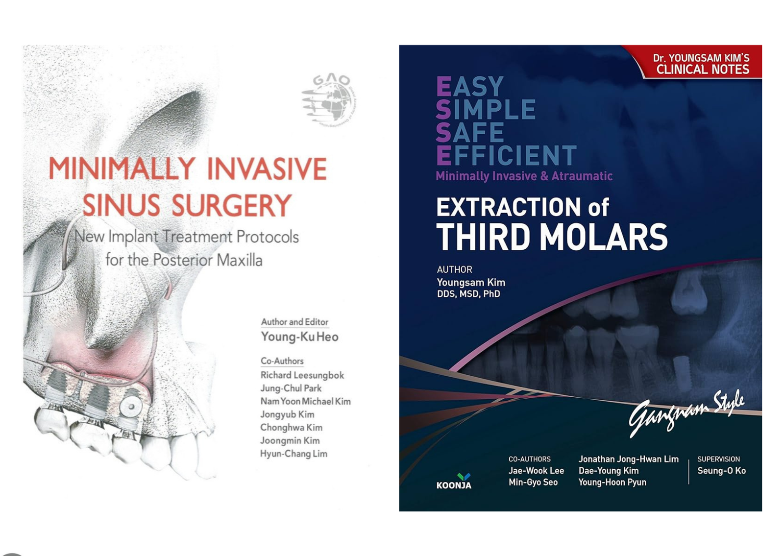 Minimally invasive sinus surgery + Extraction of Third Molars [Bundle]
