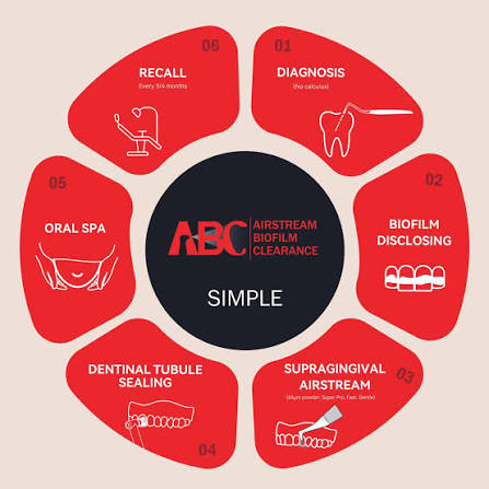 ABC Oral Care Protocol - Woodpecker PT-E Air Prophylaxis