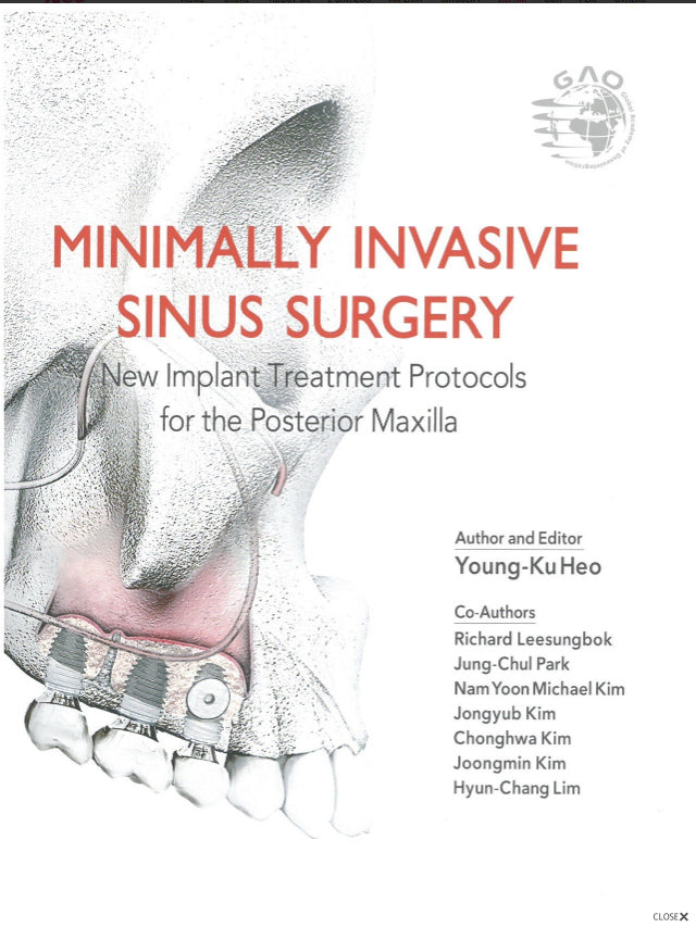 Minimally invasive sinus surgery book
