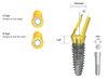 IS Hex Angled Abutment (15°) - Neo Dental